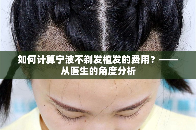 如何计算宁波不剃发植发的费用？——从医生的角度分析