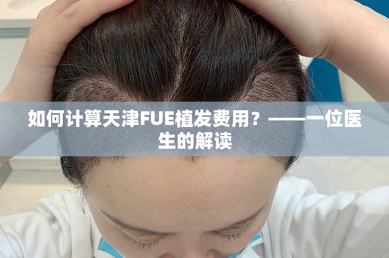 如何计算天津FUE植发费用？——一位医生的解读