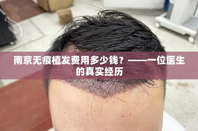 南京无痕植发费用多少钱？——一位医生的真实经历