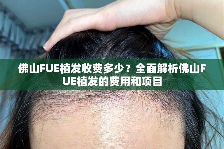 佛山FUE植发收费多少？全面解析佛山FUE植发的费用和项目