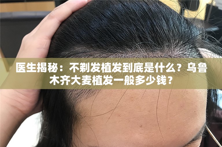 医生揭秘：不剃发植发到底是什么？乌鲁木齐大麦植发一般多少钱？