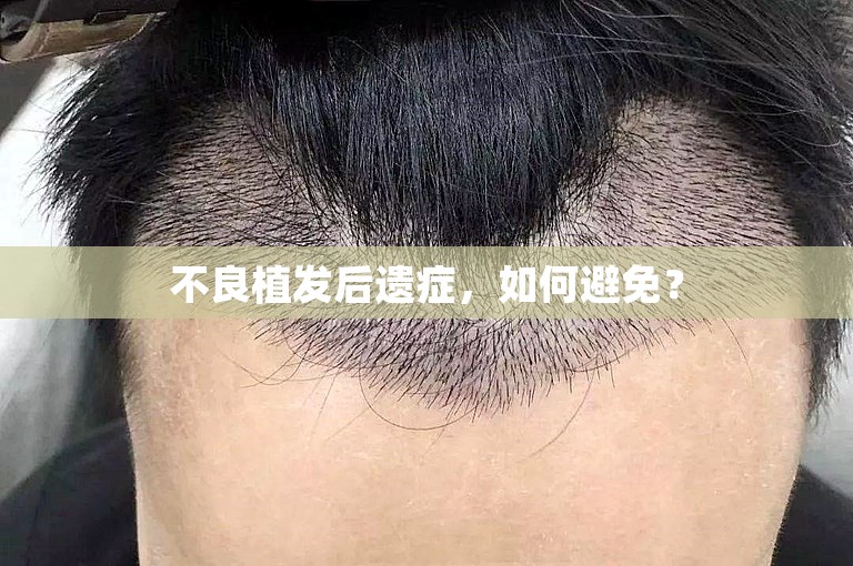 不良植发后遗症，如何避免？