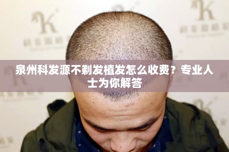 泉州科发源不剃发植发怎么收费？专业人士为你解答