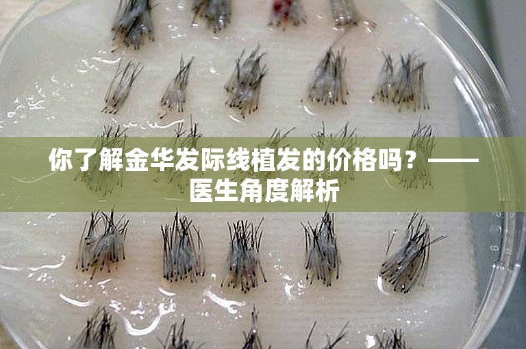 你了解金华发际线植发的价格吗？——医生角度解析