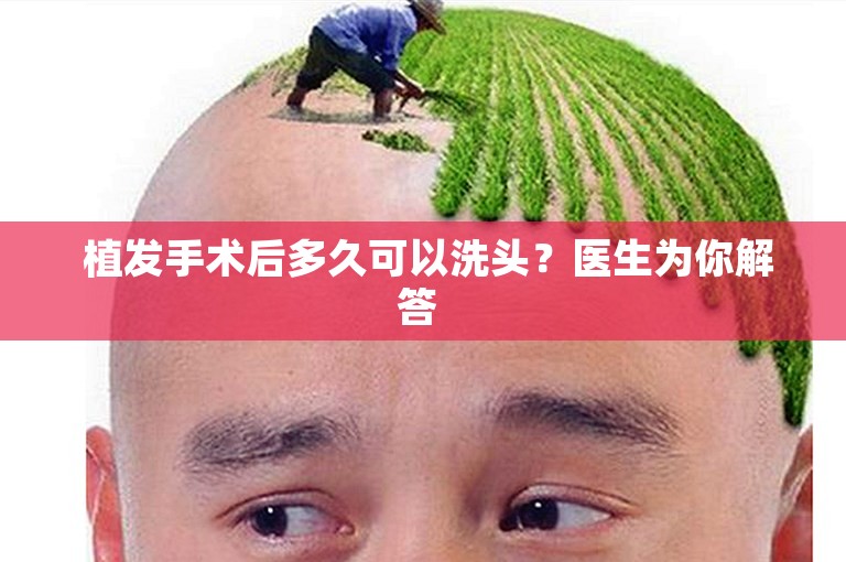  植发手术后多久可以洗头？医生为你解答 