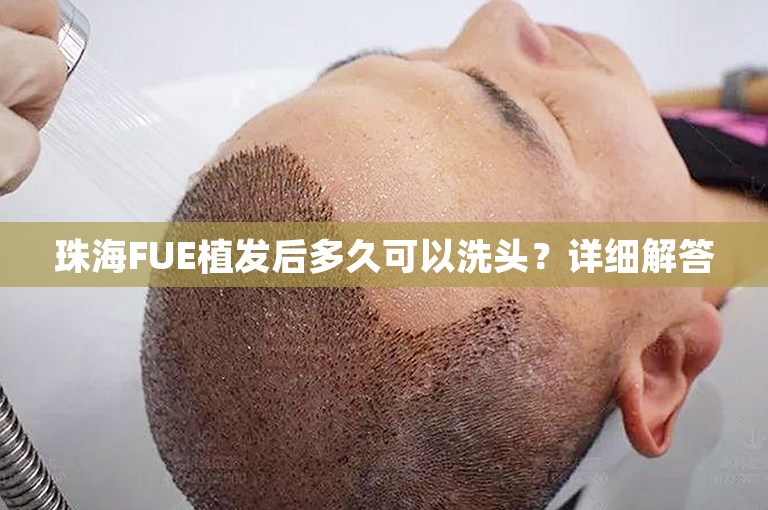 珠海FUE植发后多久可以洗头？详细解答