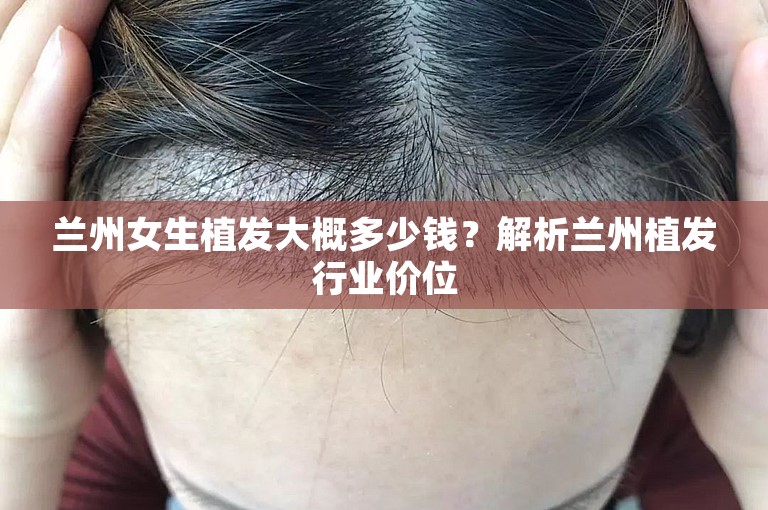 兰州女生植发大概多少钱？解析兰州植发行业价位