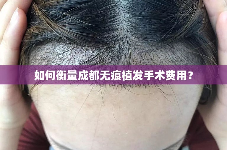 如何衡量成都无痕植发手术费用？