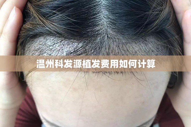 温州科发源植发费用如何计算