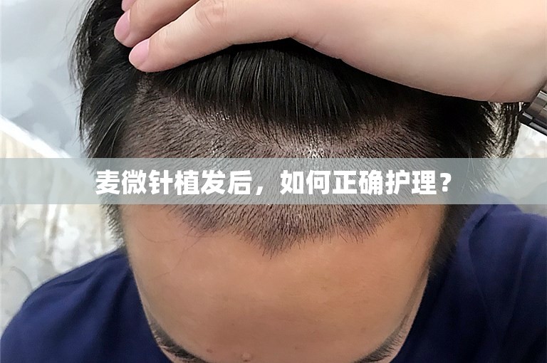 麦微针植发后，如何正确护理？