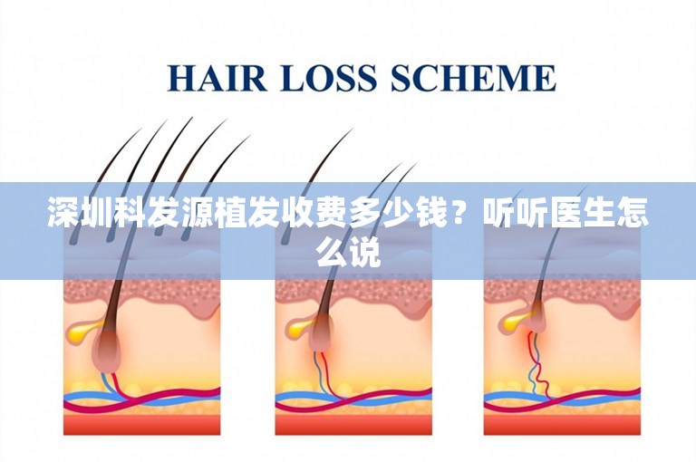 深圳科发源植发收费多少钱？听听医生怎么说