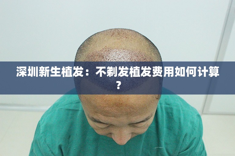 深圳新生植发：不剃发植发费用如何计算？