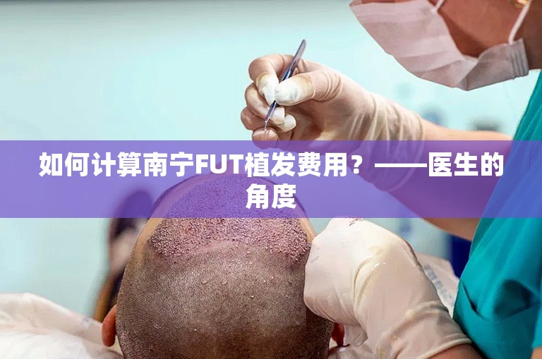 如何计算南宁FUT植发费用？——医生的角度