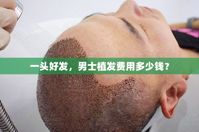 一头好发，男士植发费用多少钱？