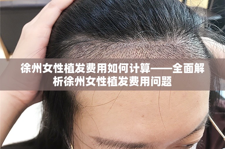 徐州女性植发费用如何计算——全面解析徐州女性植发费用问题