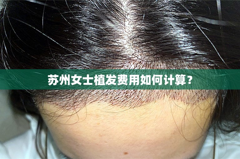 苏州女士植发费用如何计算？