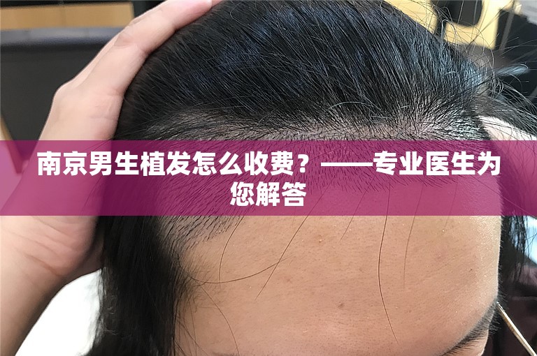 南京男生植发怎么收费？——专业医生为您解答