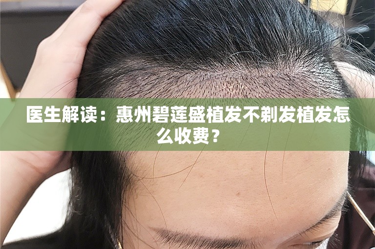 医生解读：惠州碧莲盛植发不剃发植发怎么收费？