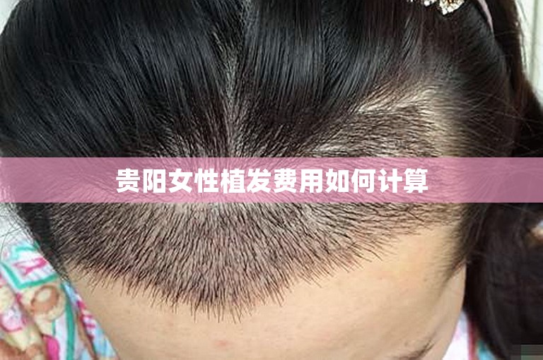 贵阳女性植发费用如何计算