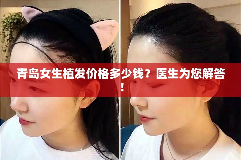 青岛女生植发价格多少钱？医生为您解答！