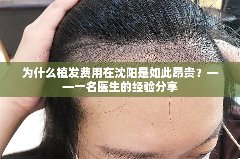 为什么植发费用在沈阳是如此昂贵？——一名医生的经验分享