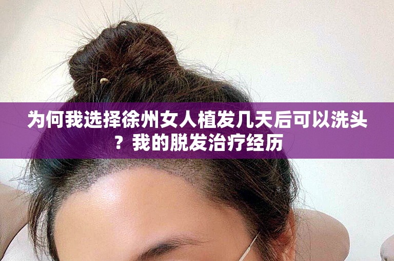 为何我选择徐州女人植发几天后可以洗头？我的脱发治疗经历