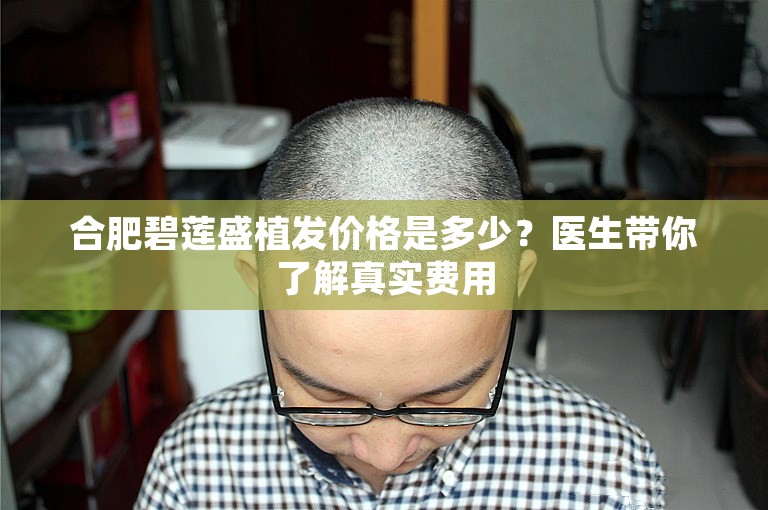 合肥碧莲盛植发价格是多少？医生带你了解真实费用