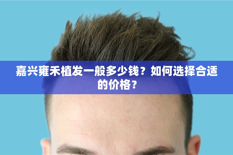 嘉兴雍禾植发一般多少钱？如何选择合适的价格？