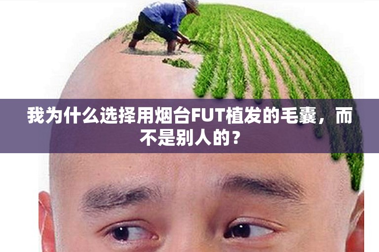 我为什么选择用烟台FUT植发的毛囊，而不是别人的？