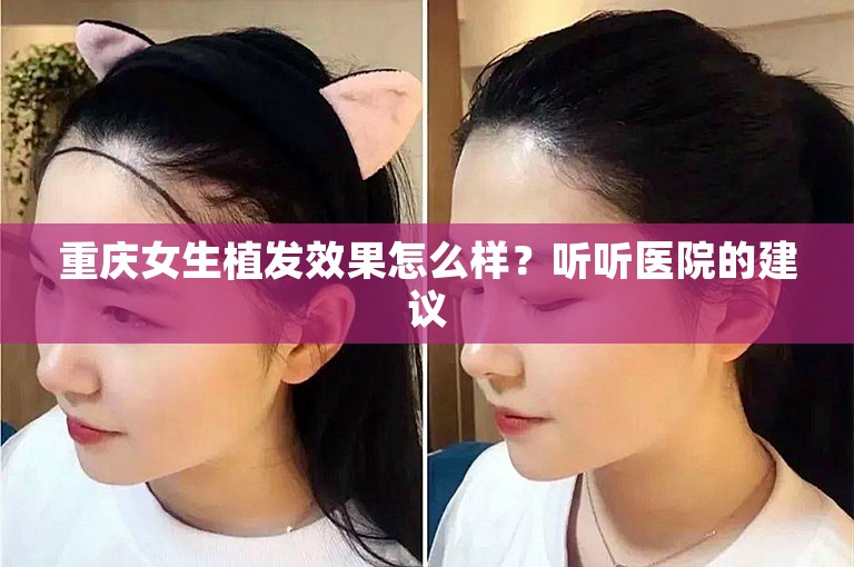 重庆女生植发效果怎么样？听听医院的建议