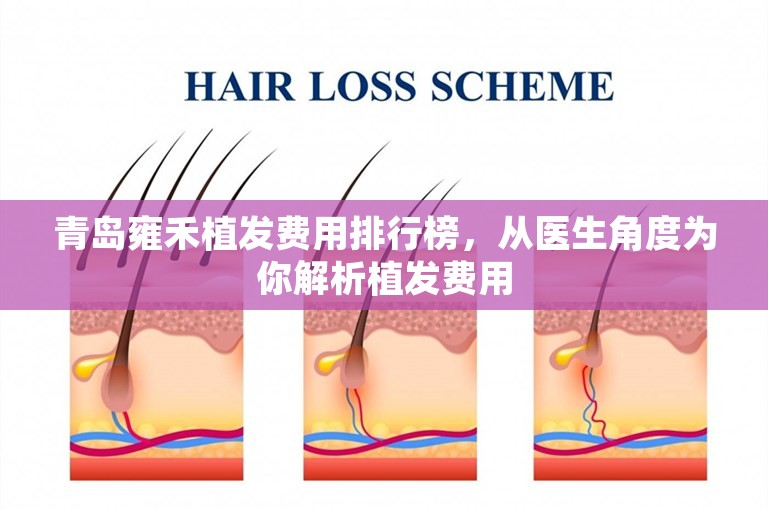 青岛雍禾植发费用排行榜，从医生角度为你解析植发费用