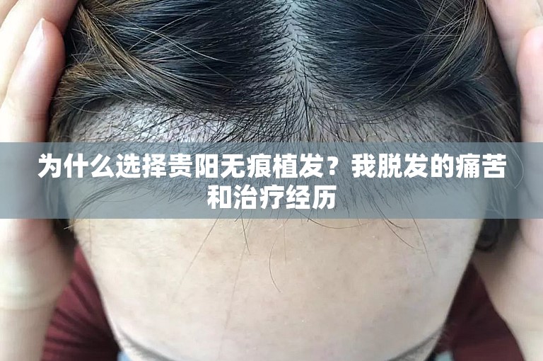 为什么选择贵阳无痕植发？我脱发的痛苦和治疗经历