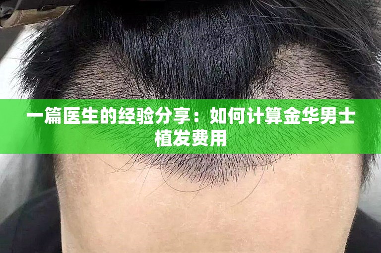 一篇医生的经验分享：如何计算金华男士植发费用