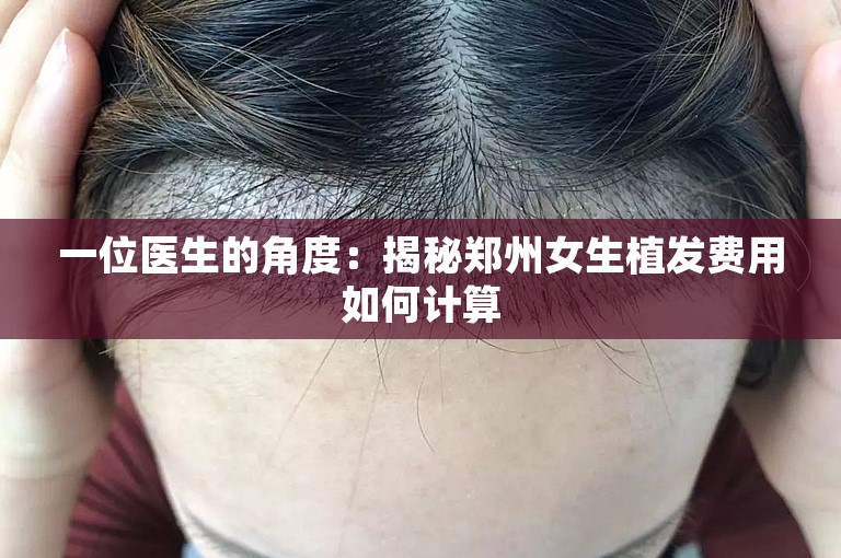 一位医生的角度：揭秘郑州女生植发费用如何计算