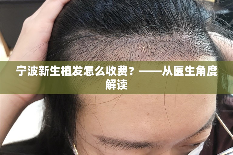 宁波新生植发怎么收费？——从医生角度解读