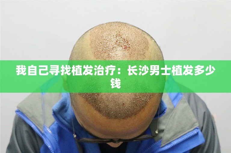 我自己寻找植发治疗：长沙男士植发多少钱