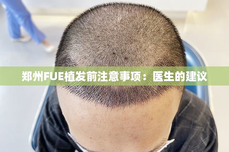 郑州FUE植发前注意事项：医生的建议