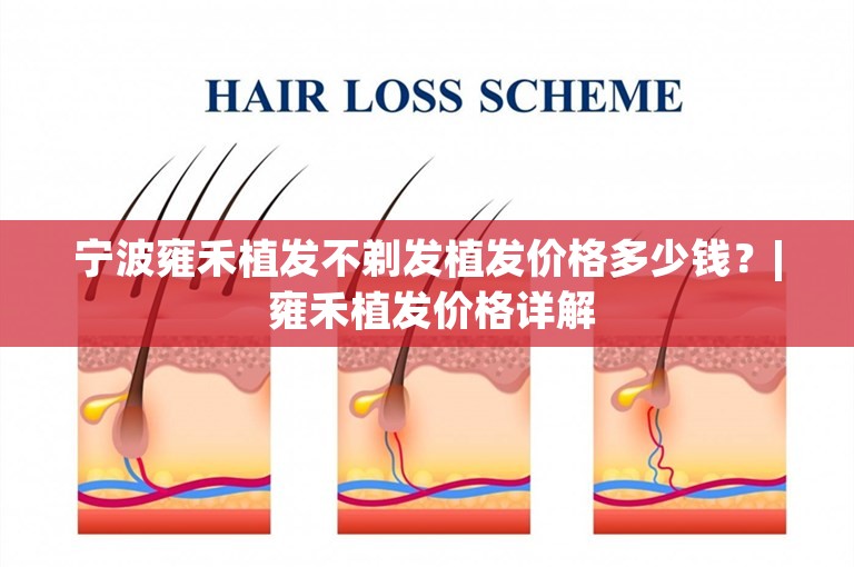 宁波雍禾植发不剃发植发价格多少钱？| 雍禾植发价格详解