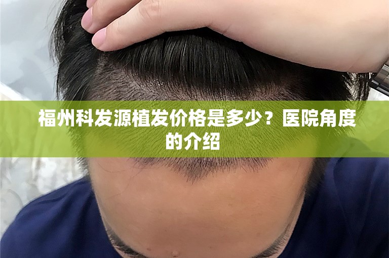  福州科发源植发价格是多少？医院角度的介绍 