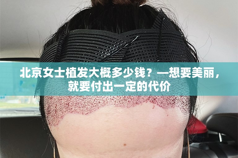 北京女士植发大概多少钱？—想要美丽，就要付出一定的代价