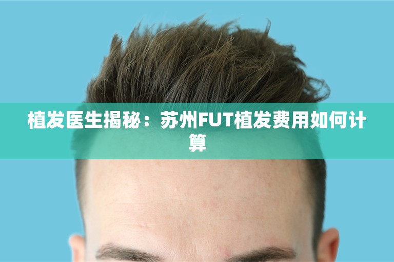 植发医生揭秘：苏州FUT植发费用如何计算