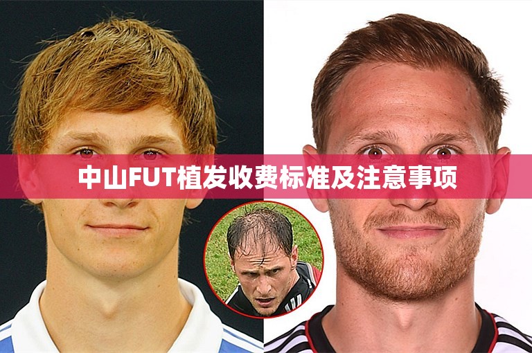 中山FUT植发收费标准及注意事项