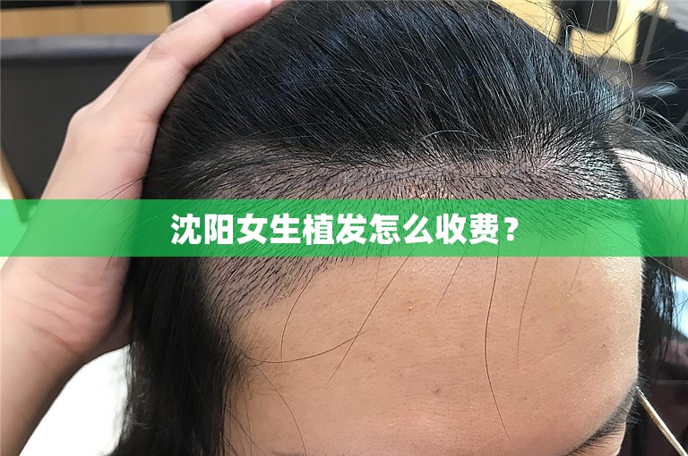 沈阳女生植发怎么收费？