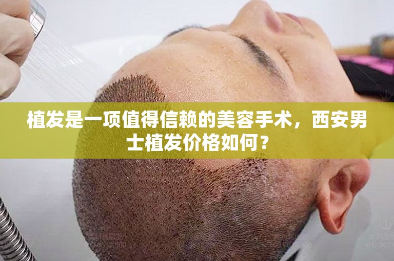 植发是一项值得信赖的美容手术，西安男士植发价格如何？