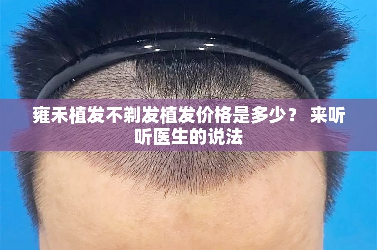 雍禾植发不剃发植发价格是多少？ 来听听医生的说法