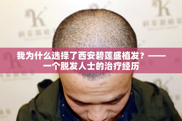 我为什么选择了西安碧莲盛植发？——一个脱发人士的治疗经历