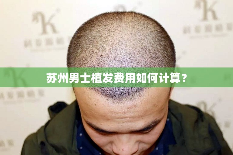 苏州男士植发费用如何计算？