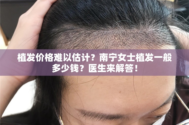 植发价格难以估计？南宁女士植发一般多少钱？医生来解答！