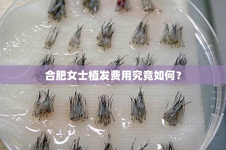 合肥女士植发费用究竟如何？