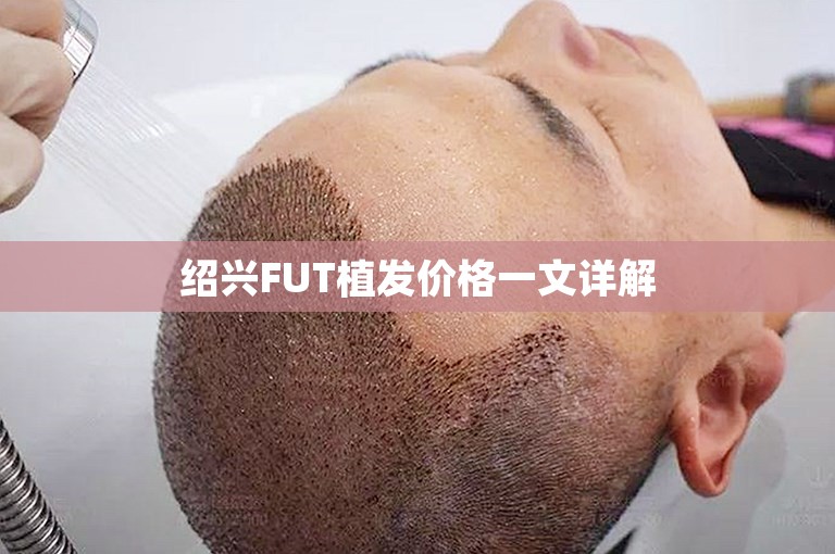 绍兴FUT植发价格一文详解